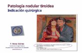 Patología nodular tiroidea · Patología nodular tiroidea . Nódulo tiroideo único: Coloide, Hiperplasia / Adenoma, Quiste . Bocios multinodulares . Bocios endotorácicos . Bocios