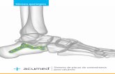 Sistema de placas de osteosíntesis para calcáneo · 2015-03-13 · placas para tratar las características de estas fracturas. • Perfil bajo: las placas MINI-Calc tienen un grosor