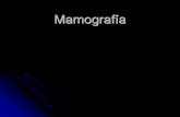 Mamografía - LOAICIGAloaiciga.com/documentos/mamografia_estudiantes.pdf · Generalidades Sensibilidad 60 -90% (según edad, tamaño, localización y aspecto mamográfico del tumor)