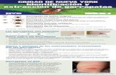 CIUDAD DE NUEVA YORK Identificación y extracción de garrapatas · Signos y síntomas de las enfermedades transmitidas por las garrapatas • Enfermedad de Lyme: Los síntomas incluyen