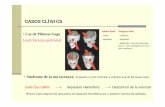 CASOS CLÍNICS - antic.spcn.catantic.spcn.cat/ATT00264.pdf · Lesió Cos Callòs Separació Hemisferis Descontrol de la voluntat Primers casos després del operacións de separació