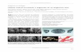 Litiasis vesical secundaria a migración de un fragmento óseo - …scielo.isciii.es/pdf/aue/v33n2/v33n2a24.pdf · 2009-08-18 · Secuencia radiológica de la migración de un islote