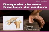 Después de una fractura de cadera (PDF) · Conozca más sobre la fractura de cadera La cadera es la articulación del cuerpo que más peso soporta. Es común que se produzca una