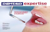 Enfermedades periodontales y halitosis · ciente se queja de halitosis no objetivable. • Halitofobia: cuando la queja de halitosis es persistente y no ob-jetivable. En el segmento