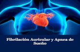 Fibrilación Auricular y Apnea de Sueñoscc.org.co/wp-content/uploads/2020/01/Fibrilación-auricular-y-apnea-del-sueño.pdfque ocurren durante la apnea se asocian a fluctuaciones en