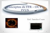 Conceptos de FFR OCT - IVUS - colegiodehemodinamia.orgcolegiodehemodinamia.org/images/memorias/calinov... · Reserva de Flujo Fraccional FFR 2 •Reserva de Flujo Fraccional nos indica