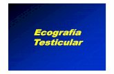 21.- Ecografia testicular [Modo de compatibilidad]€¦ · Pequeño hidrocele. Cubiertas testiculares engrosadas. Orquitis. Ecografía normal con imagen hipoecogénica que simula