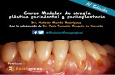 #ModularMucogingival · Resumen del curso de cirugía plástica periodontal y periimplantaria 1 módulo opcional totalmente práctico ... tiempo y a dos tiempos quirúrgicos. - Injerto