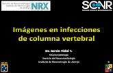 Dr. Aarón Vidal T.sociedadchilenaparasitologia.cl/wp-content/uploads/2018/... · 2018-11-05 · Puntos clave INFECCIONES DE COLUMNA VERTERBRAL • Causas bacterianas, granulomatosas