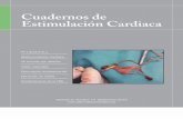 Cuadernos de Estimulación Cardiaca nº14secardiologia.es/images/stories/secciones/estimulacion/cuadernos... · La tracción manual se empleó en el 44% de los centros, estiletes