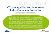 Complicaciones blefaroplastia · Instilar una gota del gel en el fondo del saco conjuntival inferior, de 1 a 4 veces al día, en intervalos regulares repartidas en función de las