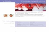Hoja de indicaciones PIR - Dr. C. Andreoni Aumento ... · Img. 19 Contorno labial de los tejidos blandos. Img. 20 Situación clínica 18 meses después de la implantación. Img. 17