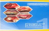Cuaderno Cirugía Oral y Prótesisons.pe/libros/05_Cirugia_Protesis.pdf · protesi5 parcial removible. inmediatamente después de la exodontia Se procedió a replegar an angu'ar para