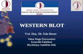 WESTERN BLOT · Western Blot Western Blot testi moleküler biyolojide protein solüsyonunda aranan bir proteinin olup olmadığını ve varsa ne kadar olduğunu anlamak için ...