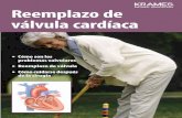 Reemplazo de válvula cardíaca (PDF) - Veterans Affairs · Cuando una válvula no funciona bien Una válvula con problemas tal vez no se abra lo suficiente, no cierre lo suficientemente