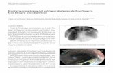 Ruptura espontánea del esófago (síndrome de Boerhaave ...scielo.isciii.es/pdf/diges/v103n9/es_imagenes2.pdf · Un esofagograma con con-traste hidrosoluble mostró una cavidad en