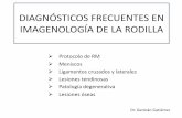 IMAGENOLOGÍA DE LA RODILLA - ATRI · 2018-11-08 · - osteocondritis disecante. 3. PATOLOGÍA VASCULAR • Osteonecrosis o necrosis avascular • Infarto óseo. Infartos óseos.
