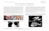Hospital Italiano de Buenos Aires - Vasculopatías congénitas · 2010-10-02 · como telangiectasia hemorrágica hereditaria (THH). Se trata de una enfermedad vascular displásica