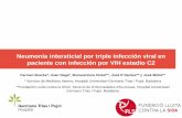 Neumonía intersticial por triple infección viral en …regist2.virology-education.com/presentations/2018/...Neumonía intersticial por triple infección viral en paciente con infección