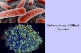 Tuberculoza. Sifilisul. Sepsisul....Tema: Tuberculoza.Sifilisul. Sepsisul. I. Micropreparate: 79. Tuberculoză miliară pulmonară. (coloraţieH-E).Indicaţii: 1. Granulom tuberculos: