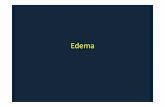 EdemaObjetivos •1. Conceptualizar el Edema •2. Definir la Semiogenesis de los Edemas •3. Identificar los Semiodiagnosticos de los Edemas Concepto •Acumulación de líquido