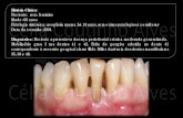 História Clínica CéliaCounhoAlves...Férula periodontal com fibersplint® e resina composta de 33 a 43. 2º - Após reavaliação da 1ª fase, foi iniciada fase cirurgica regenerativa