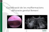 Classificació de les malformacions del tracte genital femení · Grimbizis G.F. Congenital malformations of the female genital tract: the need for a new classification system. Fertil