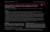 Intra-arterial versus intra venous contrast-enhanced ... · pathology in horses. The objective of this study was to compare intravenous and intra-arterial contrast-enhancement techniques