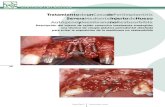TratamientodeunCasodePeriimplantitis ... · una técnica de cirugía plástica periodontal diseñada para evitar la exposición de la membrana no reabsorbible . 77 MaxillariS Septiembre