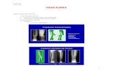 slimshady67.free.frslimshady67.free.fr/.../FRACTURES.docx · Web viewFracture du tiers moyen, proximal ou distal Fracture simple (spiroïdes ; oblique, transversale) Etat des tissus