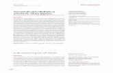 Necrosis de piel cabelluda en Circe Ancona-Castro1 Josefina … · 2015-10-12 · definitivehistopathological confirmationand appropriate treatment. This case report and literature