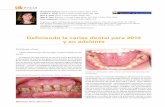 Defi niendo la caries dental para 2010 y en adelante...de caries en todo el mundo, pero no son el único determinan-te de la prevalencia de caries, tal y como demuestra la preva-lencia