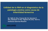 Utilidad de la RMI en el diagnóstico de la patología ...congreso.faardit.org.ar/uploads/2015/poster/2015... · La identificación de anomalías uterovaginales (AUV) es importante