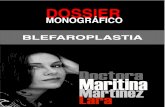 blefaroplastia - Doctora Martínez Lara · Veamos cómo van evolucionando. A finales de la década de los 30 o los primeros 40 veremos cómo la piel de los párpados superiores (tal