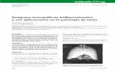 Imágenes tomográficas tridimensionales y sus aplicaciones en la patología de tórax · 2008. 8. 27. · Imágenes tomográficas tridimensionales y sus aplicaciones en la patología