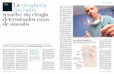 Lasinuplastia conbalón resuelvesincirugía ...€¦ · sosderinosinusitis(sinusitis) agudaycrónicasinpoliposis, conlamínimaafectaciónpa-raelpaciente,evitandocual-quiertipodecirugíayredu-ciendo,portanto,posibles