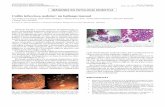 Colitis infecciosa nodular: un hallazgo inusualscielo.isciii.es/pdf/diges/v108n10/es_imagenes3.pdf · Luz Andrea Loza Vargas 1, Henar Núñez Rodríguez 1, Marina Benito Sanz , Tomás