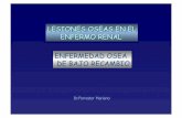 ENFERMEDAD OSEA DE BAJO RECAMBIO · 2017. 5. 19. · - ↓ FORMACION OSEA ↓ Los precursores de osteoblastos y osteoclastos ↓ N º y actividad de osteoblastos Alteración Osteoblastogénesis