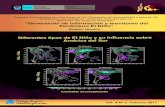 “Generación de información y monitoreo del Fenómeno El Niño”met.igp.gob.pe/publicaciones/Divulgacion_PPR_El_Nino_IGP_201702.pdfEl patrón clásico que ocurre durante El Niño