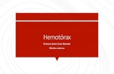 Hemotórax · 2020. 8. 6. · DEFINICIÓN Hemotórax se define como la presencia de sangre en la cavidad pleural. Hematocrito en el líquido pleural igual o mayor al 50% del hematocrito