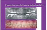 Ortodoncia predecible con aparatos invisiblespotencial de crecimiento, en el cual podemos influenciar el crecimiento mediante ortopedia de los maxilares, o se trata de un adulto, en