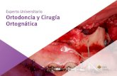 Experto Universitario Ortodoncia y Cirugía Ortognática · 06 | Presentación Este Experto Universitario en Ortodoncia y Cirugía Ortognática contiene el programa científico más