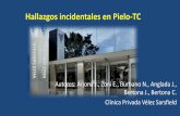 Hallazgos incidentales en Pielo-TC