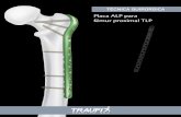 Placa ALP para fémur proximal TLP - dipromedic.com