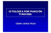 Citología por punción tiroidea - Sociedad Española de ...