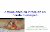Infección en herida quirúrgica