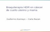 Braquiterapia HDR en cáncer de cuello uterino y mama